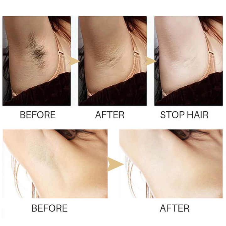 Serum epilator – O piele netedă și fără efort
