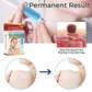 Remove your skin tags painlessly at home 