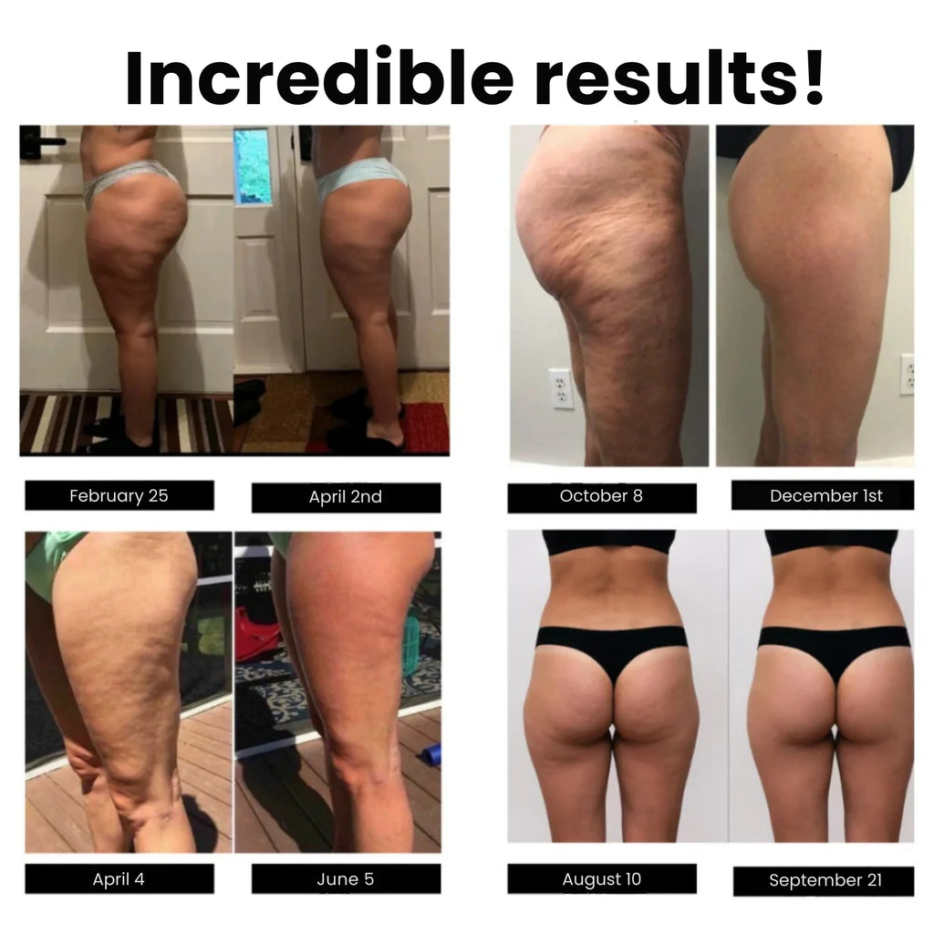 Anti-cellulitis legging — foto 4